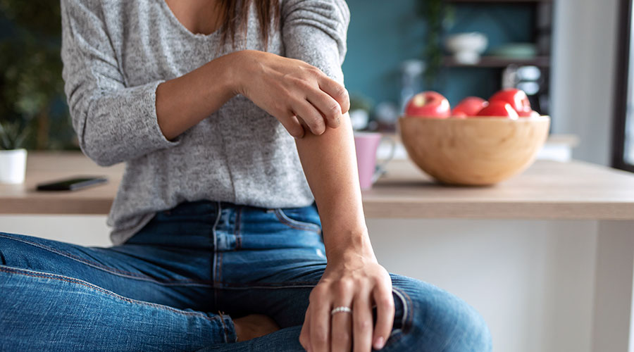 woman scratches arm due to food allergy